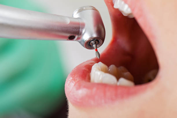 Best Urgent Dental Care for Toothaches in Sansom Park, TX